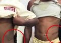 Mother Reveals How She Discovered Her Son Had Lost a Kidney
